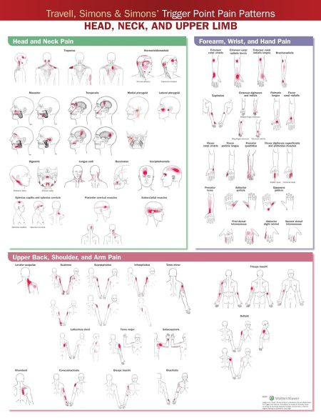 Travell, Simons & Simons’ Trigger Point Pain Patterns Wall Chart Head, Neck, and Upper Limb, Second edition