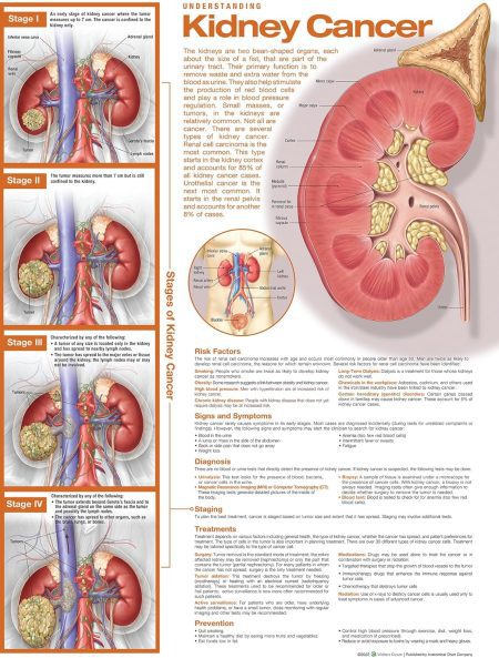 Understanding Kidney Cancer Anatomical Chart Second edition