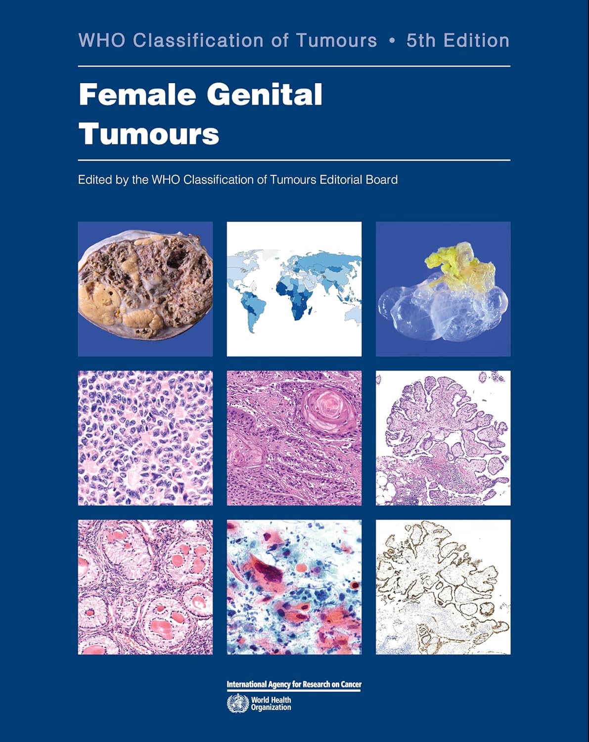 Female Genital Tumours. WHO Classification of Tumours, 5th Edition, Volume 4
