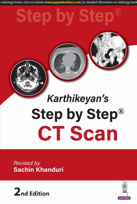 Karthikeyan's Step by Step CT Scan