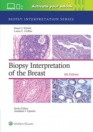 Biopsy Interpretation of the Breast: Print + eBook with Multimedia Fourth edition