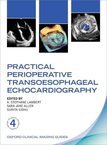 Practical Perioperative Transoesophageal Echocardiography Fourth Edition