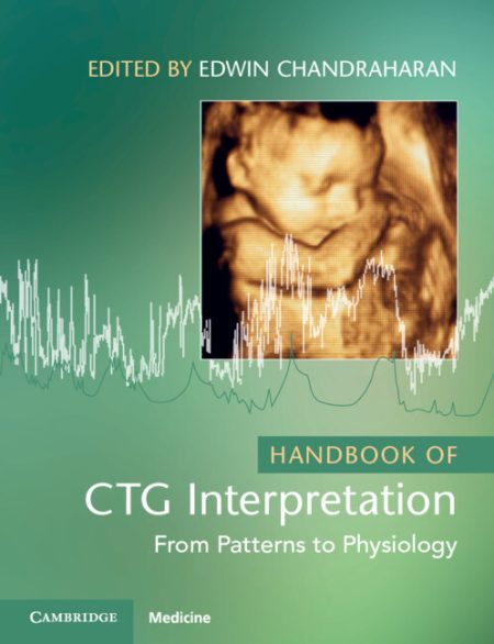 Handbook of CTG Interpretation. From Patterns to Physiology 2nd Edition