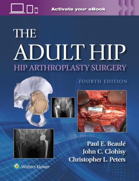 The Adult Hip: Hip Arthroplasty Surgery Print + eBook with Multimedia Fourth edition