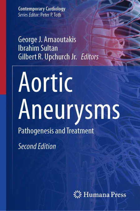 Aortic Aneurysms. Pathogenesis and Treatment