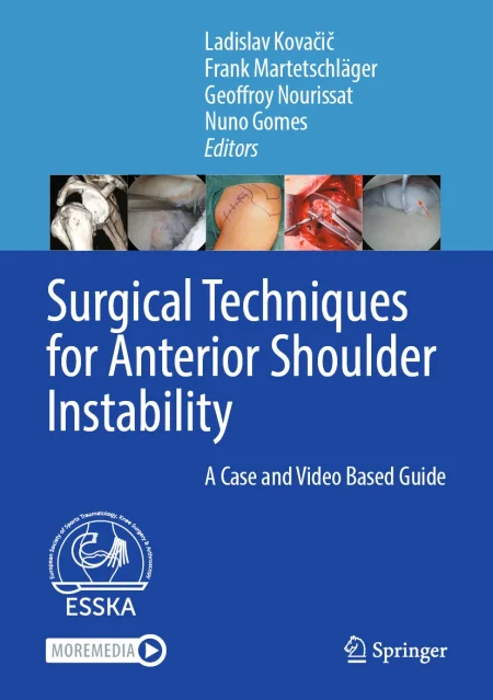 Surgical Techniques for Anterior Shoulder Instability. A Case and Video Based Guide