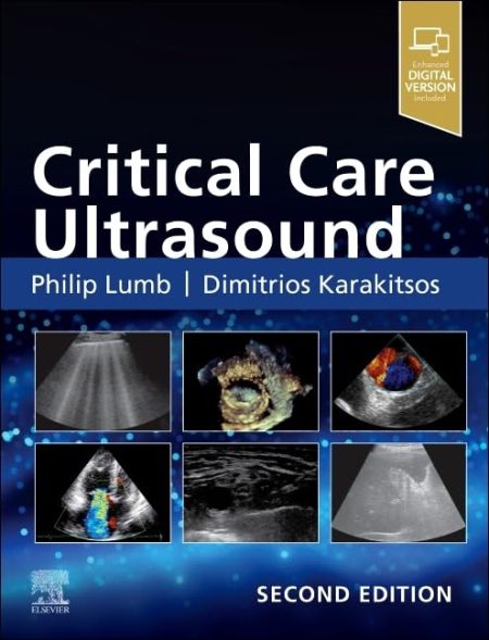 Critical Care Ultrasound, 2nd Edition