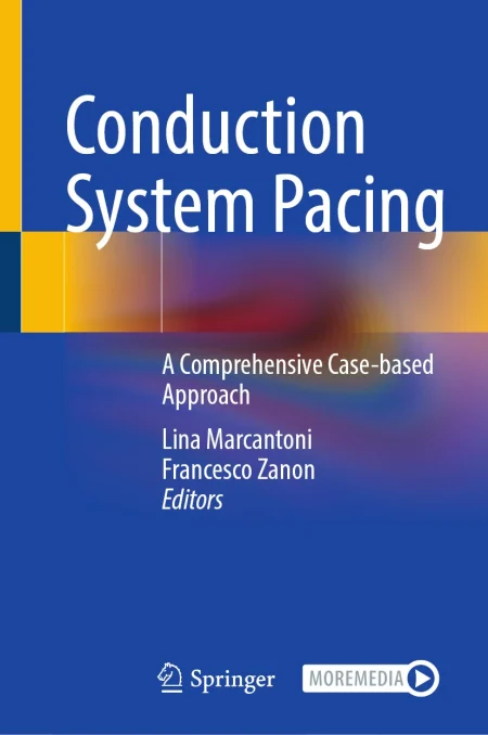 Conduction System Pacing. A Comprehensive Case-based Approach