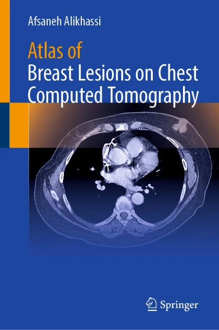 Atlas of Breast Lesions on Chest Computed Tomography